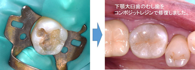 保存・修復診療部門 特徴・特色