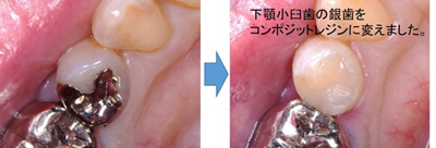 保存・修復診療部門 特徴・特色