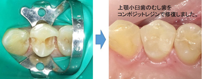 保存・修復診療部門 特徴・特色