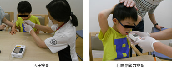 嚥下内視鏡検査 写真